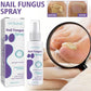 Nail Fungus Spray 100ml