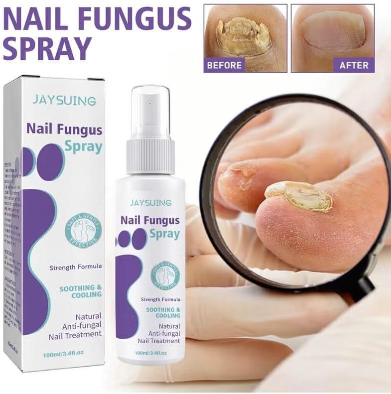 Nail Fungus Spray 100ml