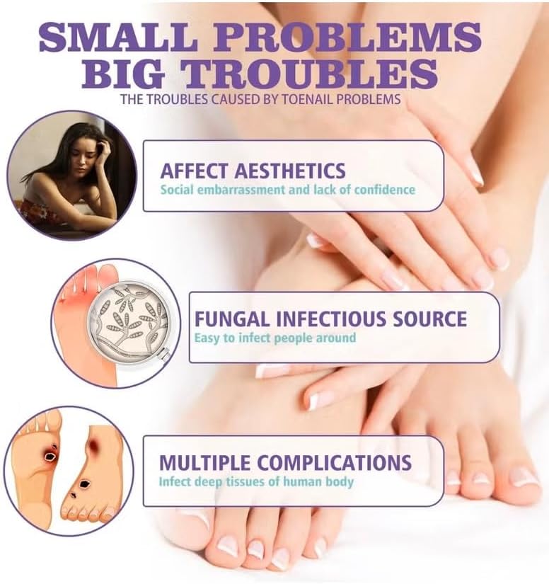 Nail Fungus Spray 100ml