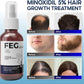FEG Hair Growth Spray+Derma Roller, Suitable For Men and Women